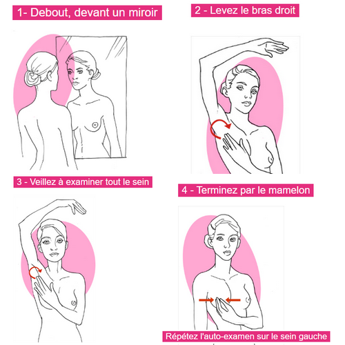 Dépistage du cancer du sein : à quoi sert l'autopalpation mammaire ?